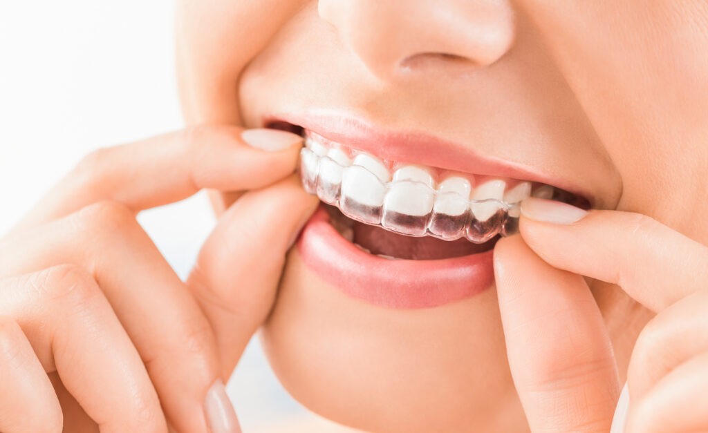 Obtenez un sourire éclatant avec des soins dentaires esthétiques